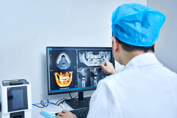 Best Emergency Treatment for Dental Infections or Abscesses in Baldwinsville, NY